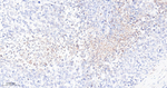 cIAP2 Recombinant Rabbit Monoclonal Antibody (6C19)