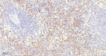 cIAP2 Antibody in Immunohistochemistry (Paraffin) (IHC (P))
