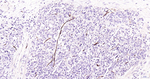 Adiponectin Recombinant Rabbit Monoclonal Antibody (10B12)