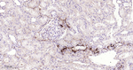 Complement C9 Recombinant Rabbit Monoclonal Antibody (8H15)