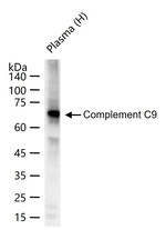 Complement C9 Antibody in Western Blot (WB)