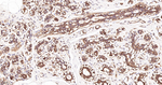 HSP90 beta Antibody in Immunohistochemistry (Paraffin) (IHC (P))