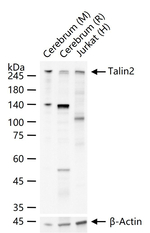 Talin 2 Antibody in Western Blot (WB)