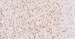 CK2 alpha-1 Antibody in Immunohistochemistry (Paraffin) (IHC (P))