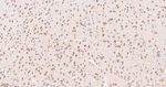 CK2 alpha-1 Antibody in Immunohistochemistry (Paraffin) (IHC (P))