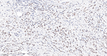 CK2 alpha-1 Antibody in Immunohistochemistry (Paraffin) (IHC (P))
