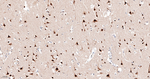 CK2 alpha-1 Antibody in Immunohistochemistry (Paraffin) (IHC (P))