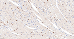 CK2 alpha-1 Antibody in Immunohistochemistry (Paraffin) (IHC (P))