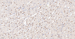 CK2 alpha-1 Antibody in Immunohistochemistry (Paraffin) (IHC (P))