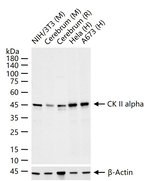 CK2 alpha-1 Antibody in Western Blot (WB)