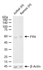 Fyn Recombinant Rabbit Monoclonal Antibody (6E11)