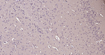 Calmodulin 1/2/3 Antibody in Immunohistochemistry (Paraffin) (IHC (P))