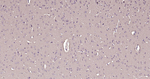 Calmodulin 1/2/3 Antibody in Immunohistochemistry (Paraffin) (IHC (P))