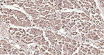 Calmodulin 1/2/3 Recombinant Rabbit Monoclonal Antibody (8D11)