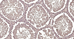 Calmodulin 1/2/3 Antibody in Immunohistochemistry (Paraffin) (IHC (P))