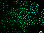 SUMO1 Recombinant Rabbit Monoclonal Antibody (5F3)