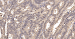 SUMO1 Antibody in Immunohistochemistry (Paraffin) (IHC (P))