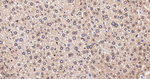 SUMO1 Antibody in Immunohistochemistry (Paraffin) (IHC (P))