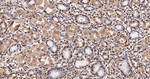 SUMO1 Antibody in Immunohistochemistry (Paraffin) (IHC (P))