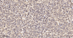 SUMO1 Antibody in Immunohistochemistry (Paraffin) (IHC (P))