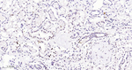 p57 Kip2 Antibody in Immunohistochemistry (Paraffin) (IHC (P))