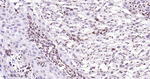 p57 Kip2 Recombinant Rabbit Monoclonal Antibody (4E7)