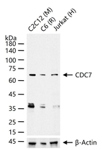 CDC7 Antibody in Western Blot (WB)