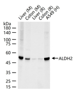 ALDH2 Recombinant Rabbit Monoclonal Antibody (5H8)