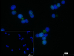 APAF1 Recombinant Rabbit Monoclonal Antibody (1D10)