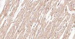 APAF1 Antibody in Immunohistochemistry (Paraffin) (IHC (P))