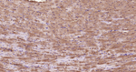 APAF1 Antibody in Immunohistochemistry (Paraffin) (IHC (P))
