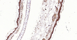 APAF1 Antibody in Immunohistochemistry (Paraffin) (IHC (P))