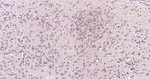 DAPK1 Antibody in Immunohistochemistry (Paraffin) (IHC (P))