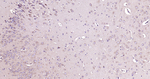 DAPK1 Antibody in Immunohistochemistry (Paraffin) (IHC (P))