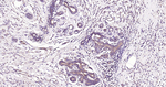 DAPK1 Antibody in Immunohistochemistry (Paraffin) (IHC (P))