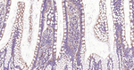 DAPK1 Recombinant Rabbit Monoclonal Antibody (6C11)