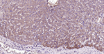 DAPK1 Antibody in Immunohistochemistry (Paraffin) (IHC (P))