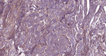 DAPK1 Antibody in Immunohistochemistry (Paraffin) (IHC (P))