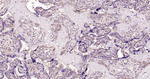 DAPK1 Antibody in Immunohistochemistry (Paraffin) (IHC (P))
