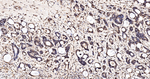 MNAR Antibody in Immunohistochemistry (Paraffin) (IHC (P))