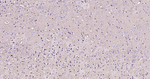 Glutamine Synthetase Antibody in Immunohistochemistry (Paraffin) (IHC (P))