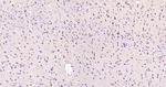 VPS34 Antibody in Immunohistochemistry (Paraffin) (IHC (P))