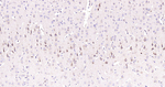 VPS34 Antibody in Immunohistochemistry (Paraffin) (IHC (P))