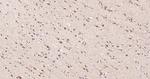 VPS34 Antibody in Immunohistochemistry (Paraffin) (IHC (P))