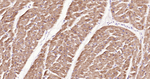 VPS34 Antibody in Immunohistochemistry (Paraffin) (IHC (P))