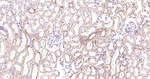 VPS34 Antibody in Immunohistochemistry (Paraffin) (IHC (P))