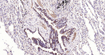 VPS34 Antibody in Immunohistochemistry (Paraffin) (IHC (P))