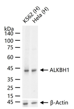 ABH1 Recombinant Rabbit Monoclonal Antibody (5B4)