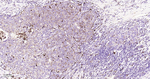 Cathepsin D Antibody in Immunohistochemistry (Paraffin) (IHC (P))