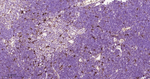 Cathepsin D Antibody in Immunohistochemistry (Paraffin) (IHC (P))